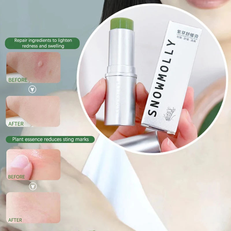 Anti Mosquito Bites Stick Mosquito Repellent Relieve Skin Redness Swelling Discomfort Prevent Itch Lithospermum Ointment